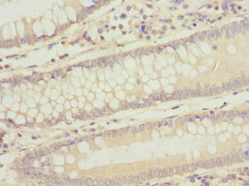 ASPSCR1 Antibody