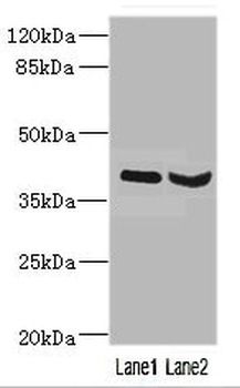HOXD10 Antibody