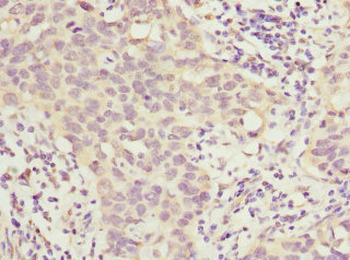 HOXD10 Antibody