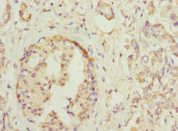 HOXD10 Antibody