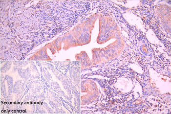 PLA2G4C Antibody