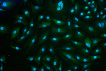 PLA2G4C Antibody