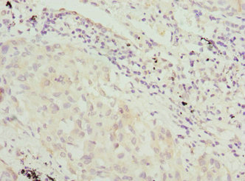 VRK1 Antibody