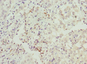 BAAT Antibody