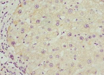 BAAT Antibody