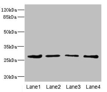 DCXR Antibody
