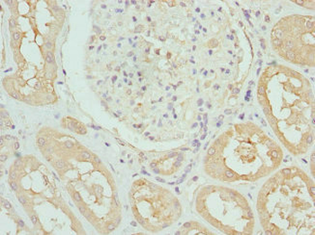DCXR Antibody