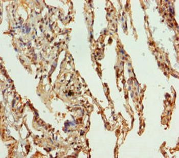 SLC34A1 Antibody
