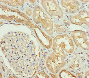 SLC34A1 Antibody