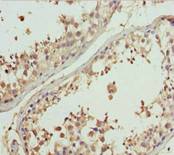 GNS Antibody