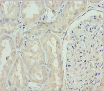 GNS Antibody