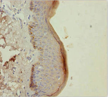KRT6A Antibody