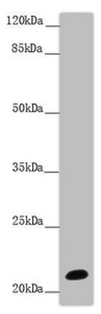 NCALD Antibody