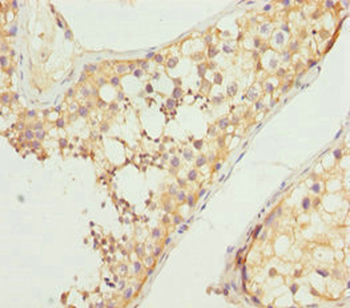 NCALD Antibody
