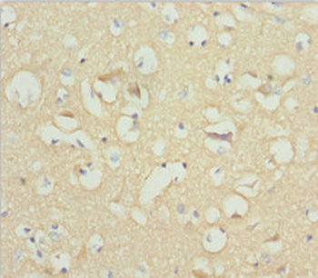 NCALD Antibody