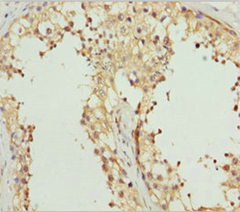 REEP1 Antibody
