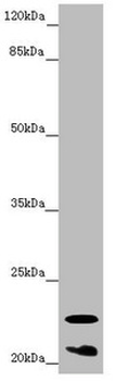 CRYGS Antibody