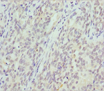 CRYGS Antibody