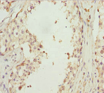 EFHC1 Antibody