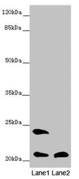 MSRB3 Antibody