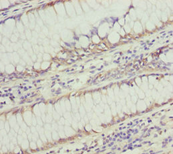 SOCS4 Antibody
