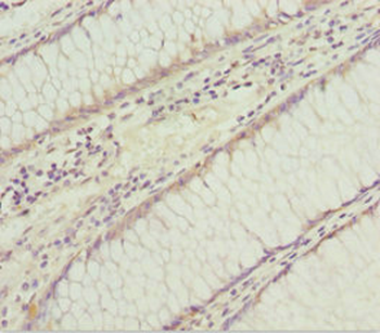 SOCS4 Antibody