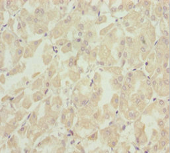 SOCS4 Antibody
