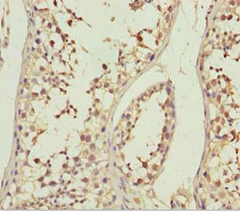 ABCB8 Antibody