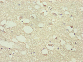 PPP2R3C Antibody
