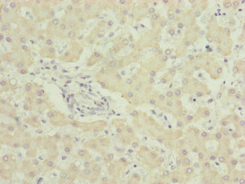 UQCC2 Antibody
