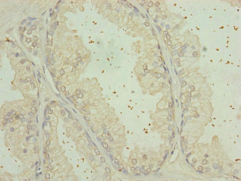 RPP25L Antibody