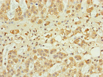 RPP25L Antibody