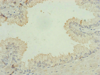 RPP25L Antibody