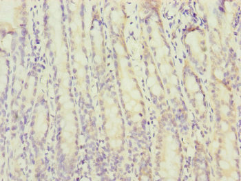 MTERF2 Antibody