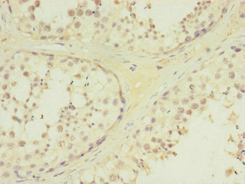MTERF2 Antibody