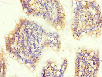 MTERF2 Antibody