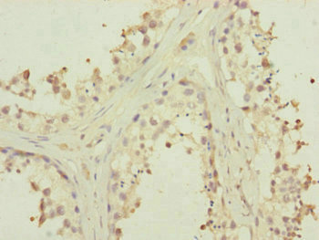 MTERF2 Antibody