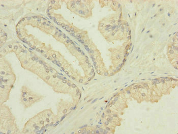MTIF3 Antibody