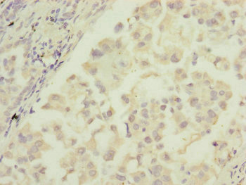 MTIF3 Antibody