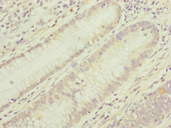 TIMM17B Antibody