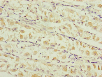 TIMM17B Antibody