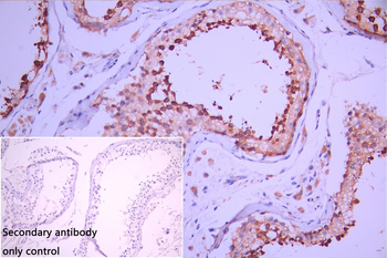 FBXL5 Antibody