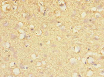 MARK1 Antibody