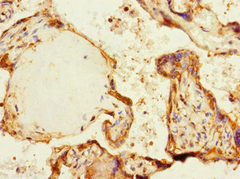 MARK1 Antibody