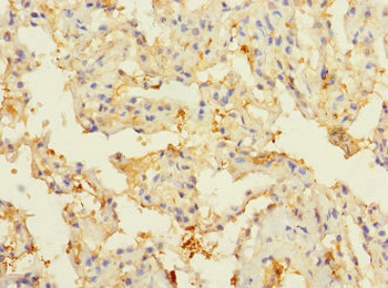 CIR1 Antibody