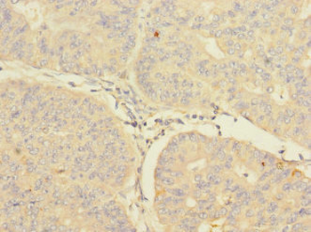 CIR1 Antibody