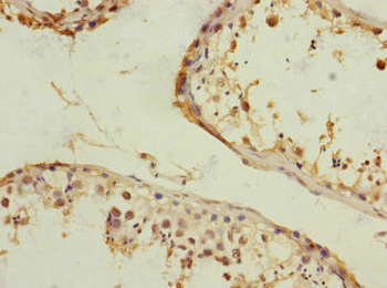 RANBP3 Antibody