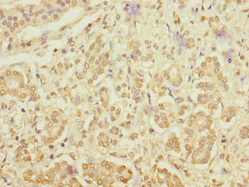 RANBP3 Antibody