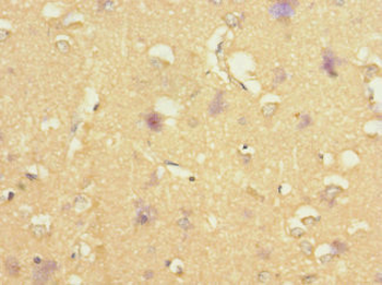 STRADA Antibody