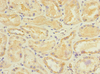 STRADA Antibody